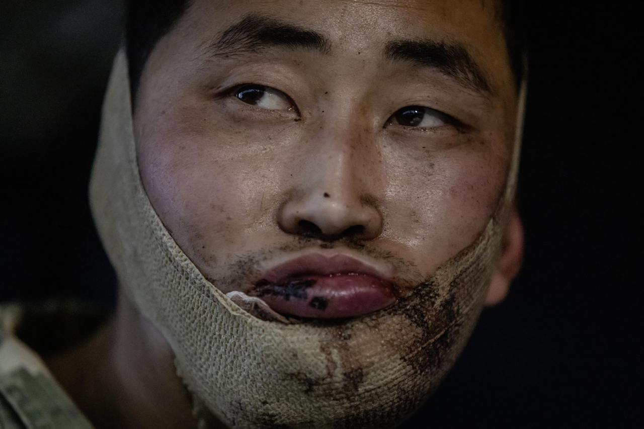 A North Korean POW captured by Ukrainian forces during hostilities in Kursk Oblast, Russia. Photo published on Jan. 11, 2025. (President Volodymyr Zelensky/Telegram)